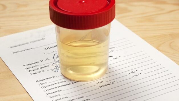 Urine analysis for arterial hypertension
